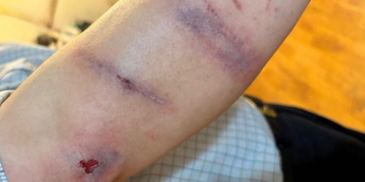 ניו יורק: חסיד כבן 50 נשדד והוכה קשות