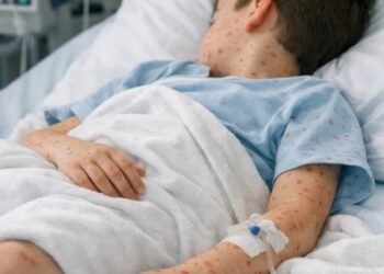 משרד הבריאות: ילד בן תשע נפטר מחצבת