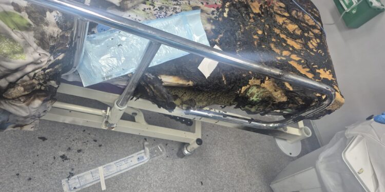 מספר נפגעים בשריפה שפרצה במרכז הרפואי ‘לניאדו’ בנתניה