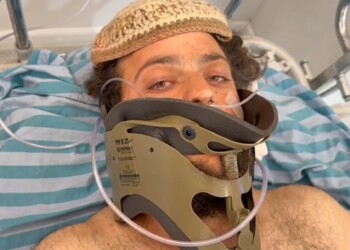 ניצול הפיגוע ליד חומש משחזר