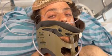 ניצול הפיגוע ליד חומש משחזר