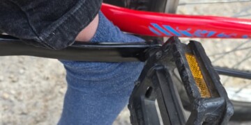 האוץ’ הרגל של הילד נתפסה באופניים בשכונת בית וגן