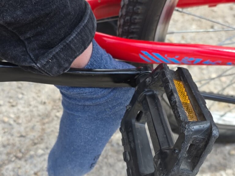 האוץ' הרגל של הילד נתפסה באופניים בשכונת בית וגן